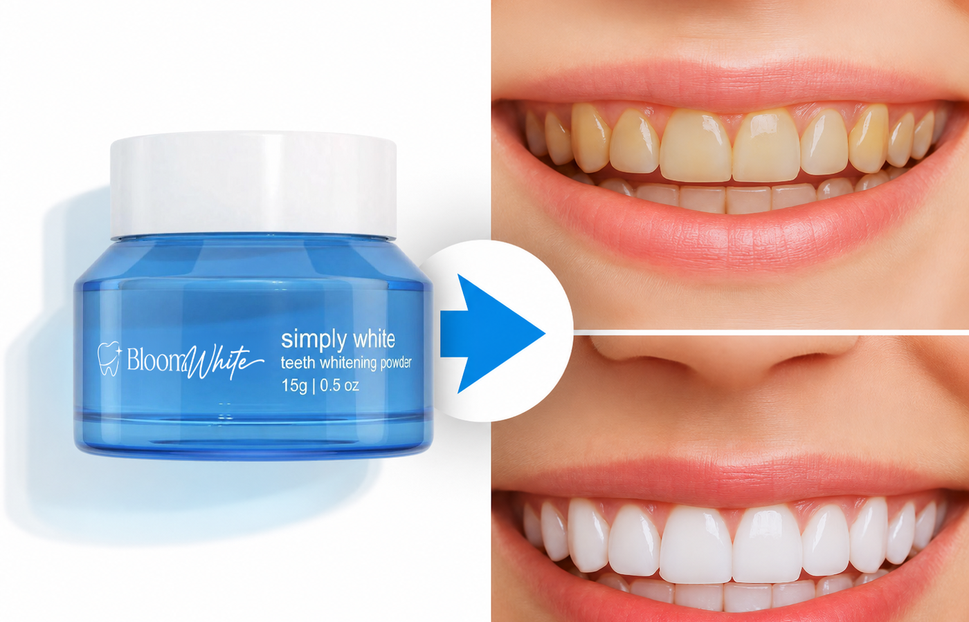 Bloom White product visual with before and after teeth whitening comparison